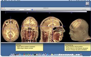 mri hdr file extension,MRI HDR File Extension: A Comprehensive Guide