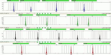 tprofile sample file,tProfile Sample File: A Comprehensive Overview